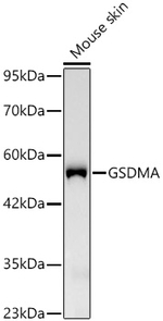 GSDMA Antibody in Western Blot (WB)