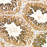 LKB1 Recombinant Rabbit Monoclonal Antibody (10S1C3)