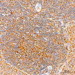 LKB1 Antibody in Immunohistochemistry (Paraffin) (IHC (P))