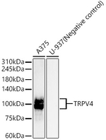 TRPV4 Recombinant Rabbit Monoclonal Antibody (4E6O6)