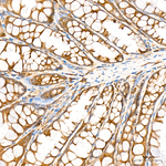 GSK3 alpha/beta Antibody in Immunohistochemistry (Paraffin) (IHC (P))