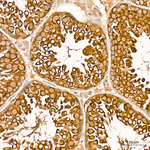 GSK3 alpha/beta Antibody in Immunohistochemistry (Paraffin) (IHC (P))