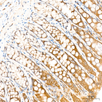 GSK3 alpha/beta Antibody in Immunohistochemistry (Paraffin) (IHC (P))