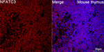 NFATC3 Recombinant Rabbit Monoclonal Antibody (4J7N7)
