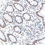 ATF2 Antibody in Immunohistochemistry (Paraffin) (IHC (P))