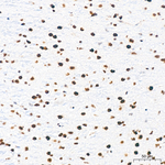 ATF2 Antibody in Immunohistochemistry (Paraffin) (IHC (P))