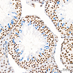 ATF2 Antibody in Immunohistochemistry (Paraffin) (IHC (P))