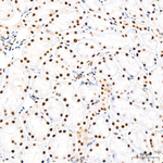 ATF2 Antibody in Immunohistochemistry (Paraffin) (IHC (P))