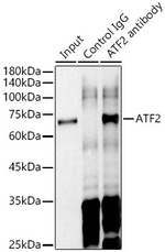 ATF2 Antibody in Immunoprecipitation (IP)