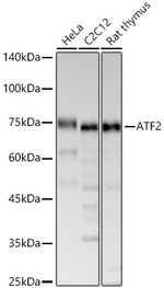 ATF2 Antibody in Western Blot (WB)