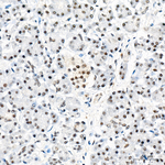 PCAF Recombinant Rabbit Monoclonal Antibody (8W6M0)