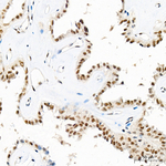 PCAF Antibody in Immunohistochemistry (Paraffin) (IHC (P))