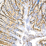 PCAF Antibody in Immunohistochemistry (Paraffin) (IHC (P))