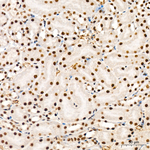 PCAF Antibody in Immunohistochemistry (Paraffin) (IHC (P))