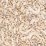 PCAF Antibody in Immunohistochemistry (Paraffin) (IHC (P))