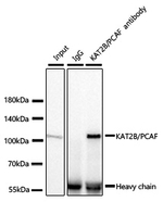 PCAF Antibody in Immunoprecipitation (IP)