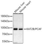PCAF Antibody in Western Blot (WB)