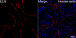 Elastin Recombinant Rabbit Monoclonal Antibody (1M2E2)