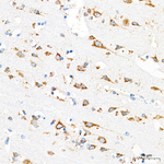 PSAP Antibody in Immunohistochemistry (Paraffin) (IHC (P))
