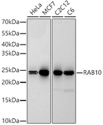 RAB10 Antibody in Western Blot (WB)