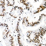 WTAP Recombinant Rabbit Monoclonal Antibody (1F5E1)