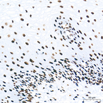 WTAP Antibody in Immunohistochemistry (Paraffin) (IHC (P))