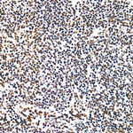 WTAP Antibody in Immunohistochemistry (Paraffin) (IHC (P))