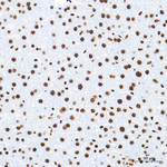 WTAP Antibody in Immunohistochemistry (Paraffin) (IHC (P))