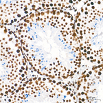 WTAP Antibody in Immunohistochemistry (Paraffin) (IHC (P))