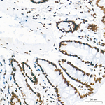 WTAP Antibody in Immunohistochemistry (Paraffin) (IHC (P))