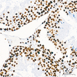 WTAP Antibody in Immunohistochemistry (Paraffin) (IHC (P))