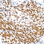 H4K12ac Recombinant Rabbit Monoclonal Antibody (10P8L4)