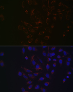 NGLY1 Antibody in Immunocytochemistry (ICC/IF)