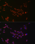 NGLY1 Recombinant Rabbit Monoclonal Antibody (7G3T10)