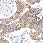 NGLY1 Antibody in Immunohistochemistry (Paraffin) (IHC (P))