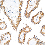 NGLY1 Antibody in Immunohistochemistry (Paraffin) (IHC (P))
