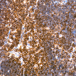 NGLY1 Antibody in Immunohistochemistry (Paraffin) (IHC (P))