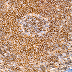 NGLY1 Antibody in Immunohistochemistry (Paraffin) (IHC (P))