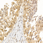 AKT1 Antibody in Immunohistochemistry (Paraffin) (IHC (P))