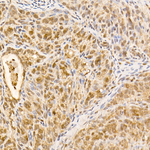 AKT1 Antibody in Immunohistochemistry (Paraffin) (IHC (P))