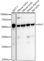 AKT1 Antibody in Western Blot (WB)