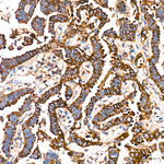 Caspase 12 Recombinant Rabbit Monoclonal Antibody (8N5Z6)