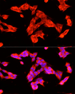 HTR3A Recombinant Rabbit Monoclonal Antibody (0I9Z4)