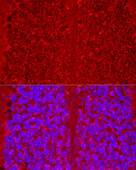 HTR3A Antibody in Immunohistochemistry (Paraffin) (IHC (P))