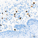 ALOX15 Antibody in Immunohistochemistry (Paraffin) (IHC (P))
