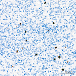 ALOX15 Antibody in Immunohistochemistry (Paraffin) (IHC (P))