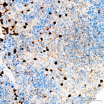 ALOX15 Antibody in Immunohistochemistry (Paraffin) (IHC (P))