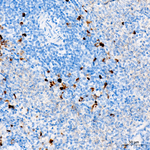 ALOX15 Antibody in Immunohistochemistry (Paraffin) (IHC (P))