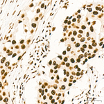 YTHDC1 Antibody in Immunohistochemistry (Paraffin) (IHC (P))