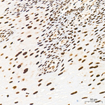 YTHDC1 Antibody in Immunohistochemistry (Paraffin) (IHC (P))